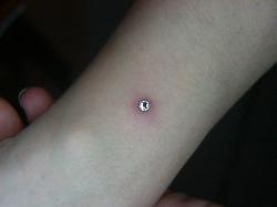 DENNIS TATTOO BEAUCE MICRODERMAL Ici, le poignet de Sylvie, quelques heures aprs l'avoir insr